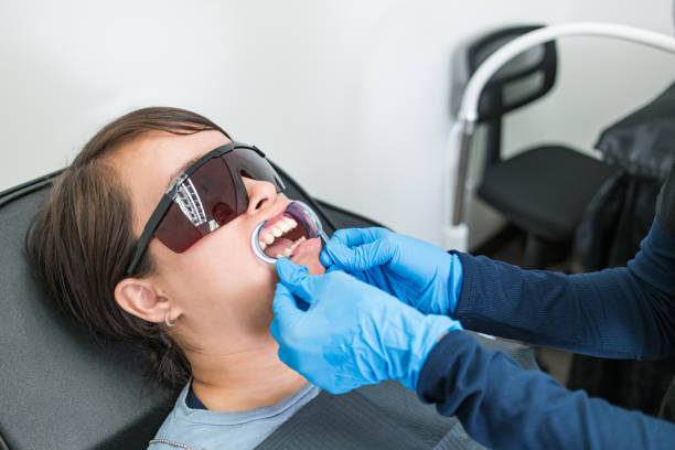 Best Emergency Wisdom Tooth Extraction in Lopezville, TX